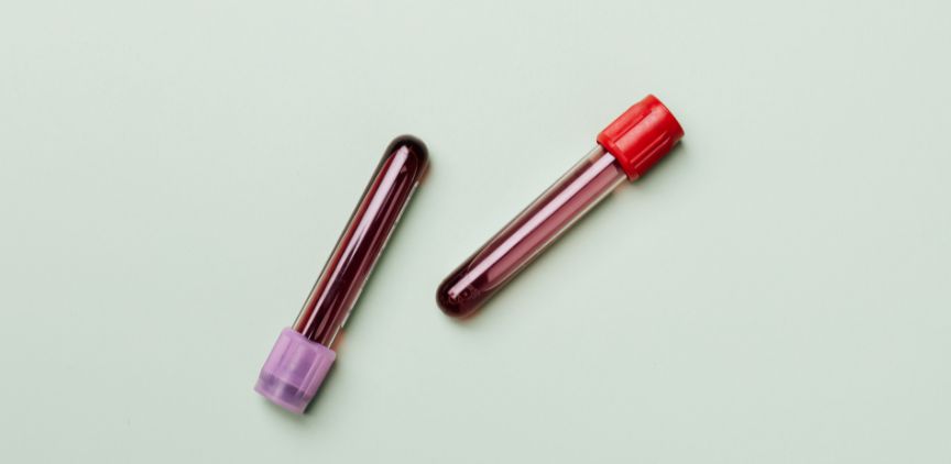 Two vials of blood on a light, mint green background